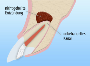 Ungeeignetes Heilen